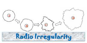 radio irregularity